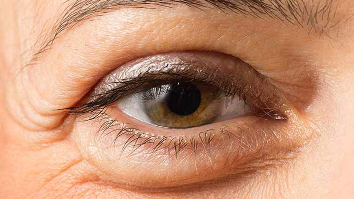 प्रेग्नेंसी के दौरान मह‍िलाओं को अक्‍सर होती है आंखों में सूजन और थकान की समस्‍या, जानें बचाव के 6 उपाय 