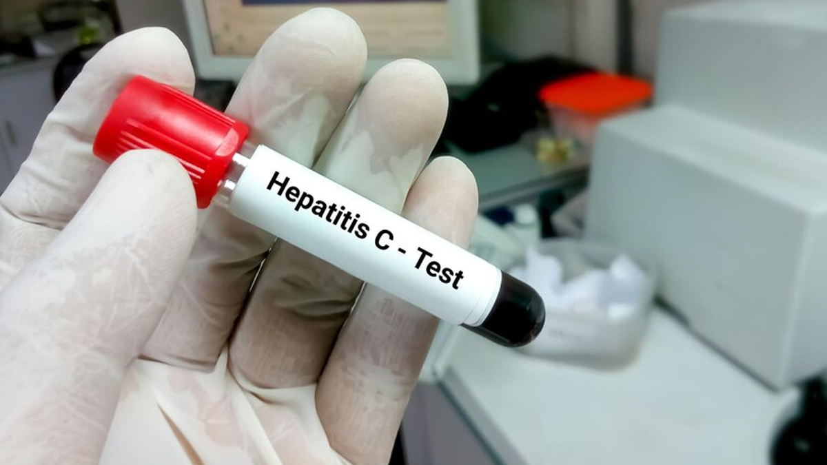 WHO Prequalifies First Hepatitis C Self-Test, OraQuick To Boost Global ...