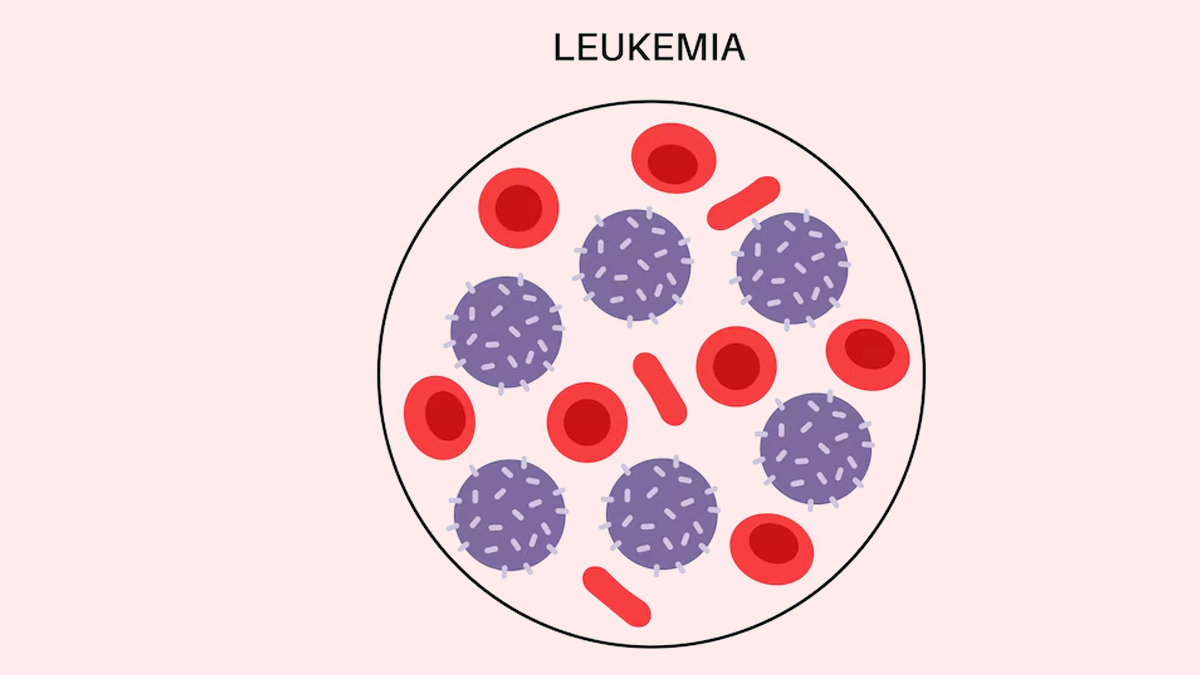leukemia