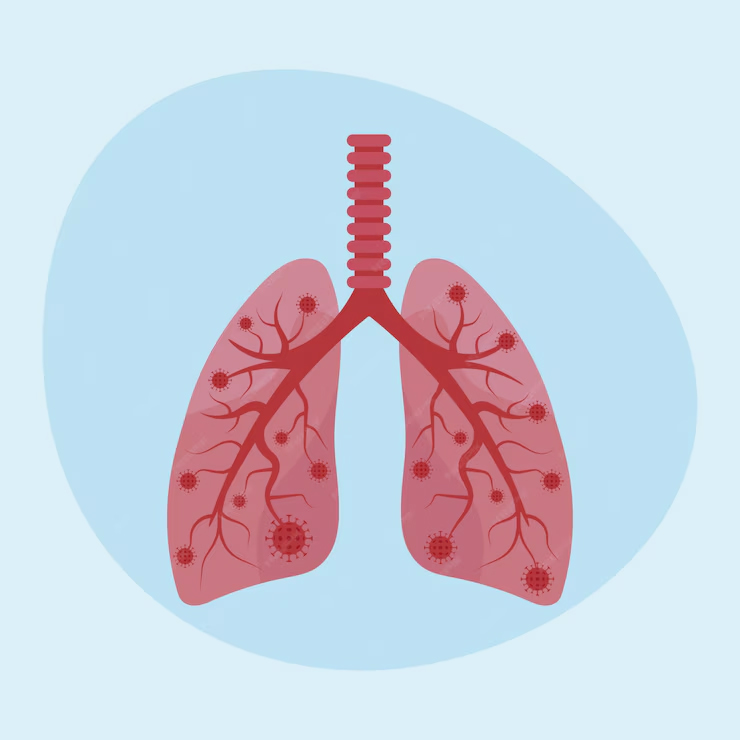 Why Is Lung Cancer Hitting Non-smoking Indians Earlier Than Westerners ...