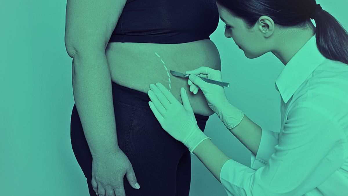 Life-Changing Bariatric Surgery Helps 30-Year-Old Woman Escape Obesity, Hypertension, Fertility Issues