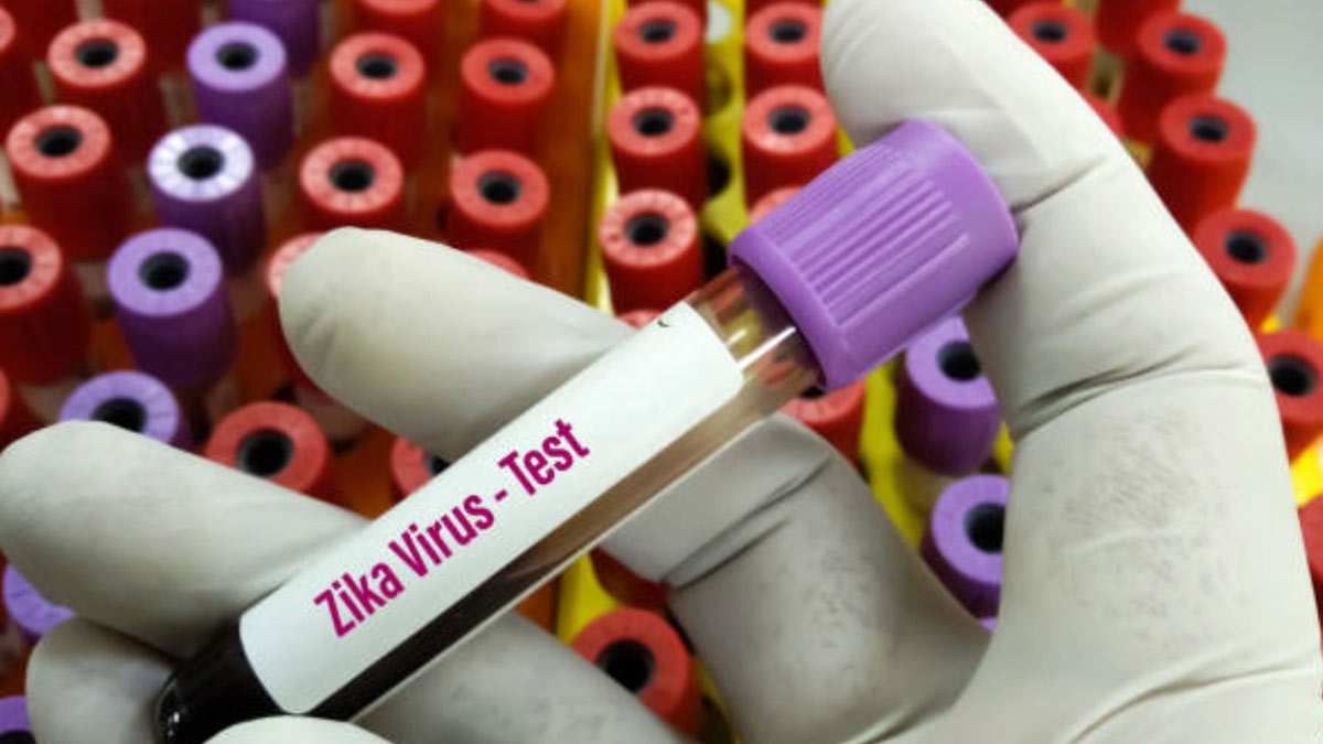 Zika Virus Transmission In Pune’s Sukhsagarnagar Area; Another Test Positive