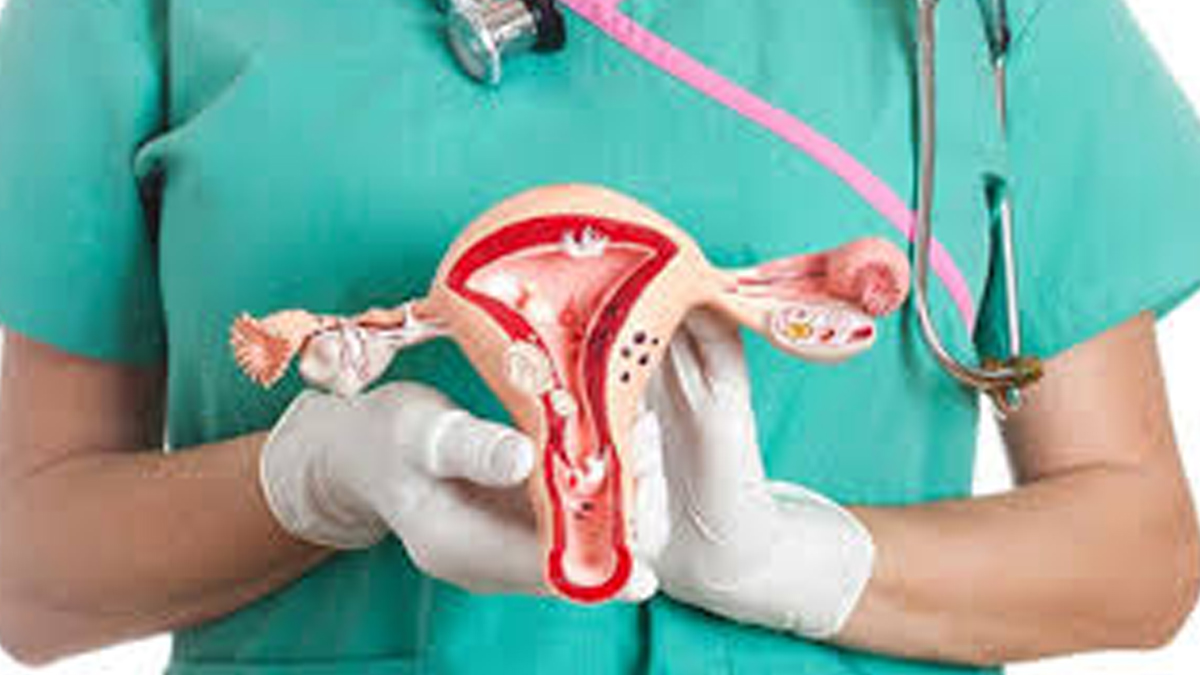 Hysterectomy