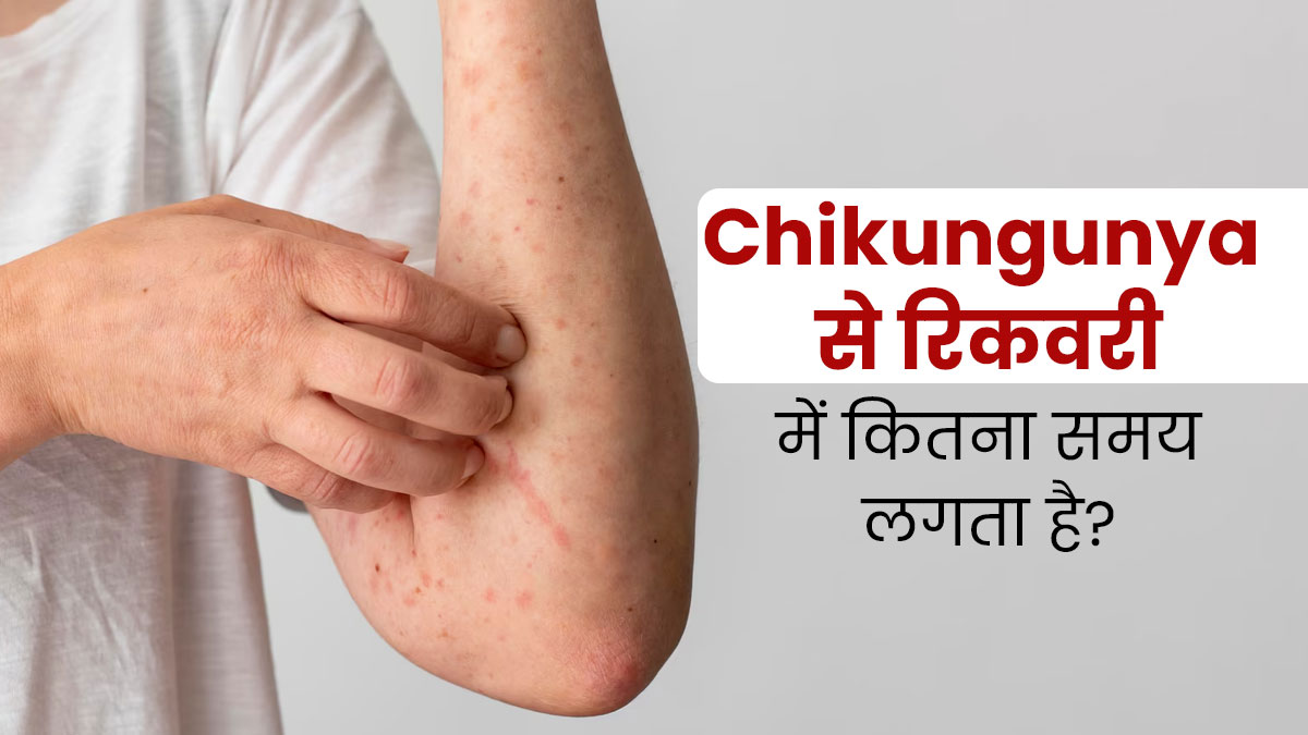 how long does it take for chikungunya to recover know from doctor in hindi OnlyMyHealth