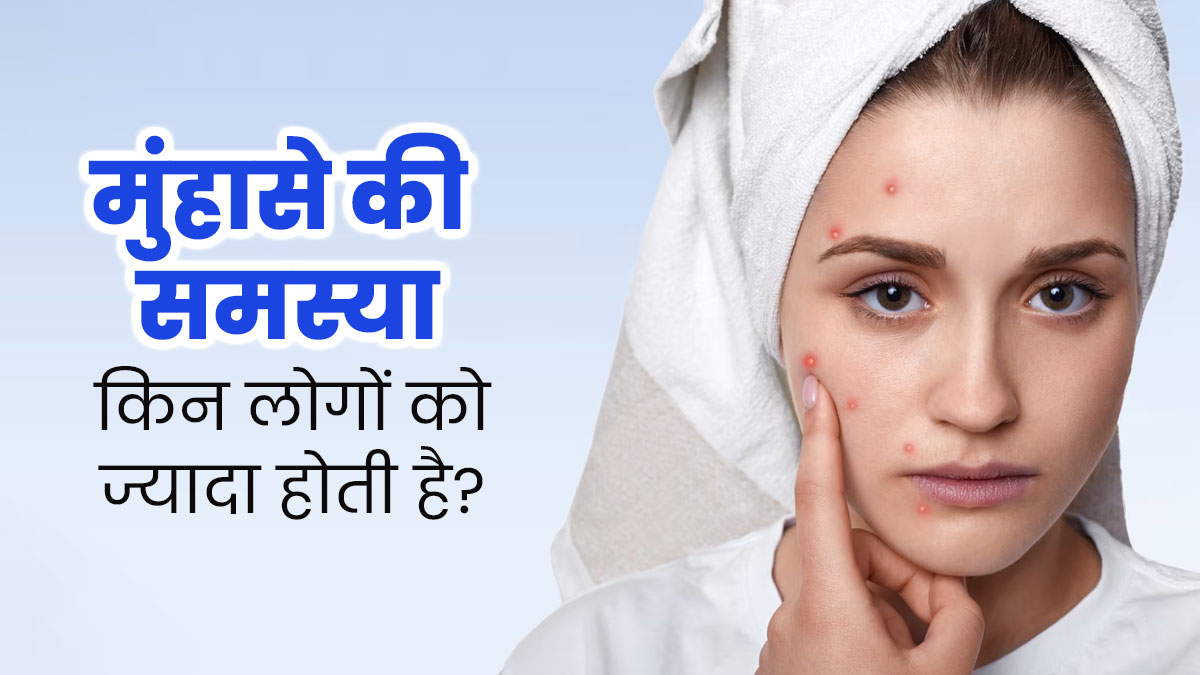 इन लोगों को अधिक होती है मुंहासों की समस्या, जानें कैसे करें बचाव 