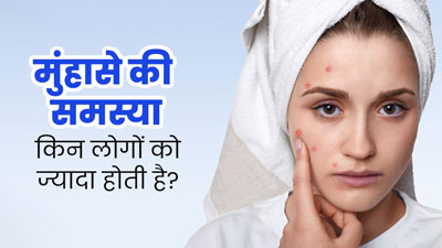 इन लोगों को अधिक होती है मुंहासों की समस्या, जानें कैसे करें बचाव 