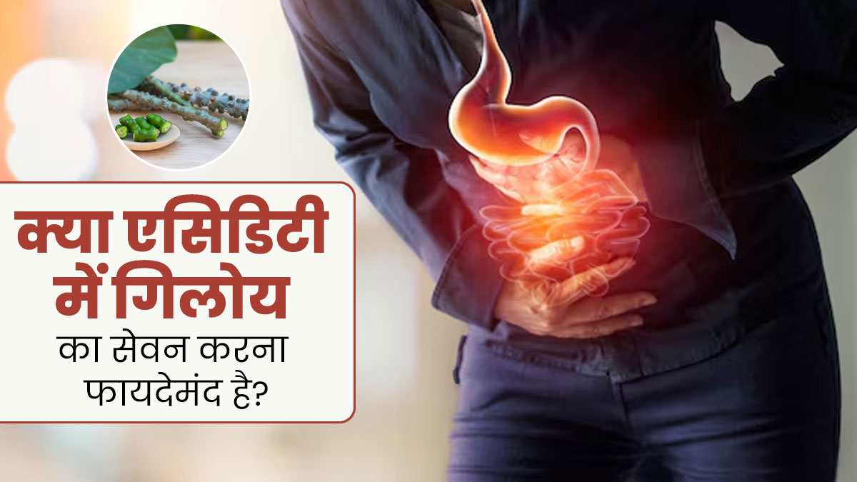 क्या गिलोय एसिडिटी की समस्या से राहत दिला सकता है? आयुर्वेदाचार्य से जानें