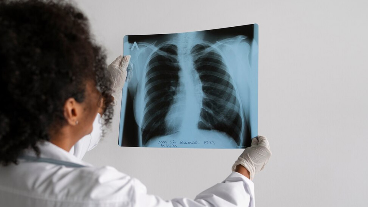 Other Risk Factors Beyond Smoking Cigarettes That Increase Chances Of Lung Cancer