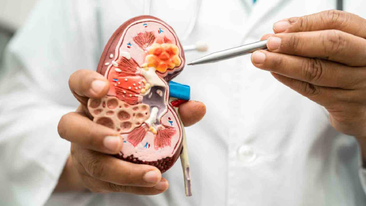 untreated kidney disease side effects