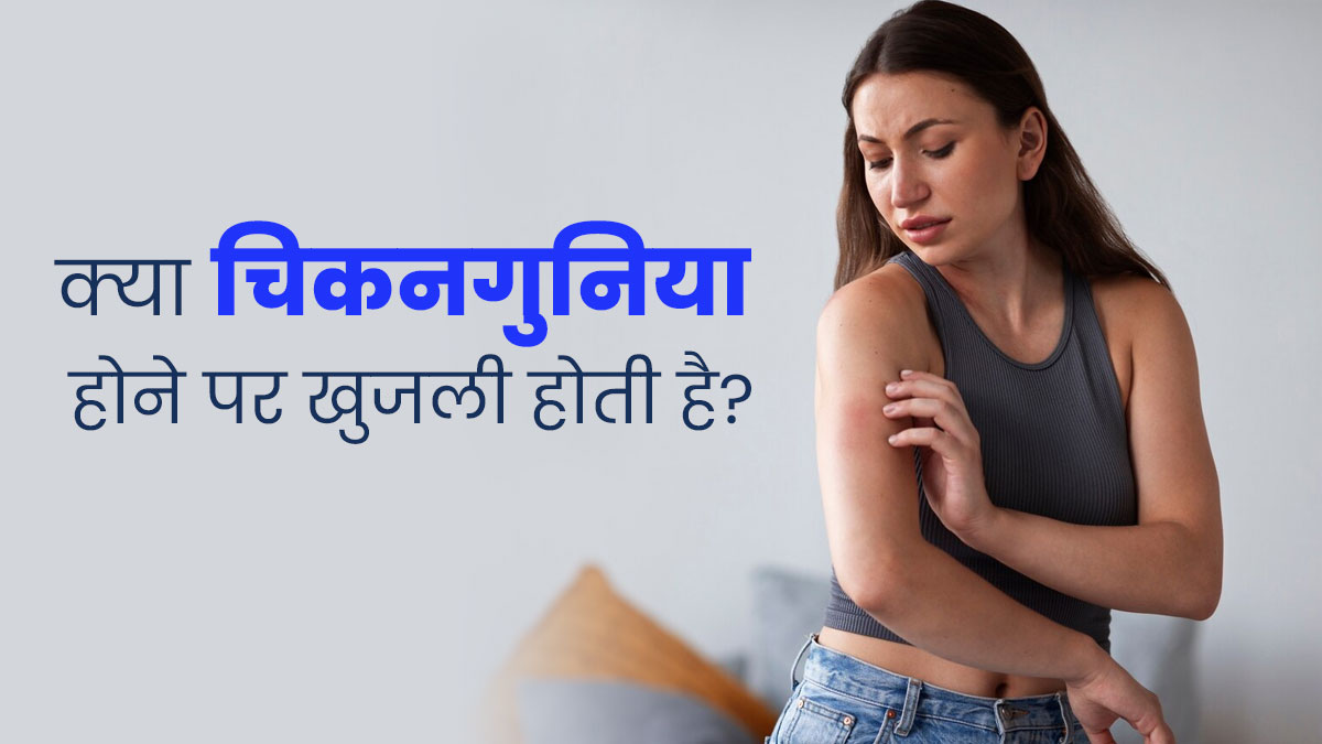 क्या चिकनगुनिया में खुजली और रैशेज की समस्या होने लगती है? इस तरह से पाएं छुटकारा