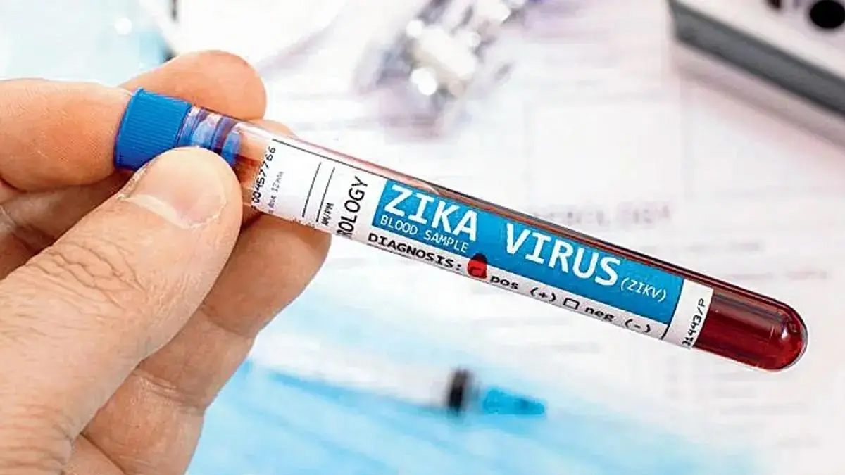 Zika Virus