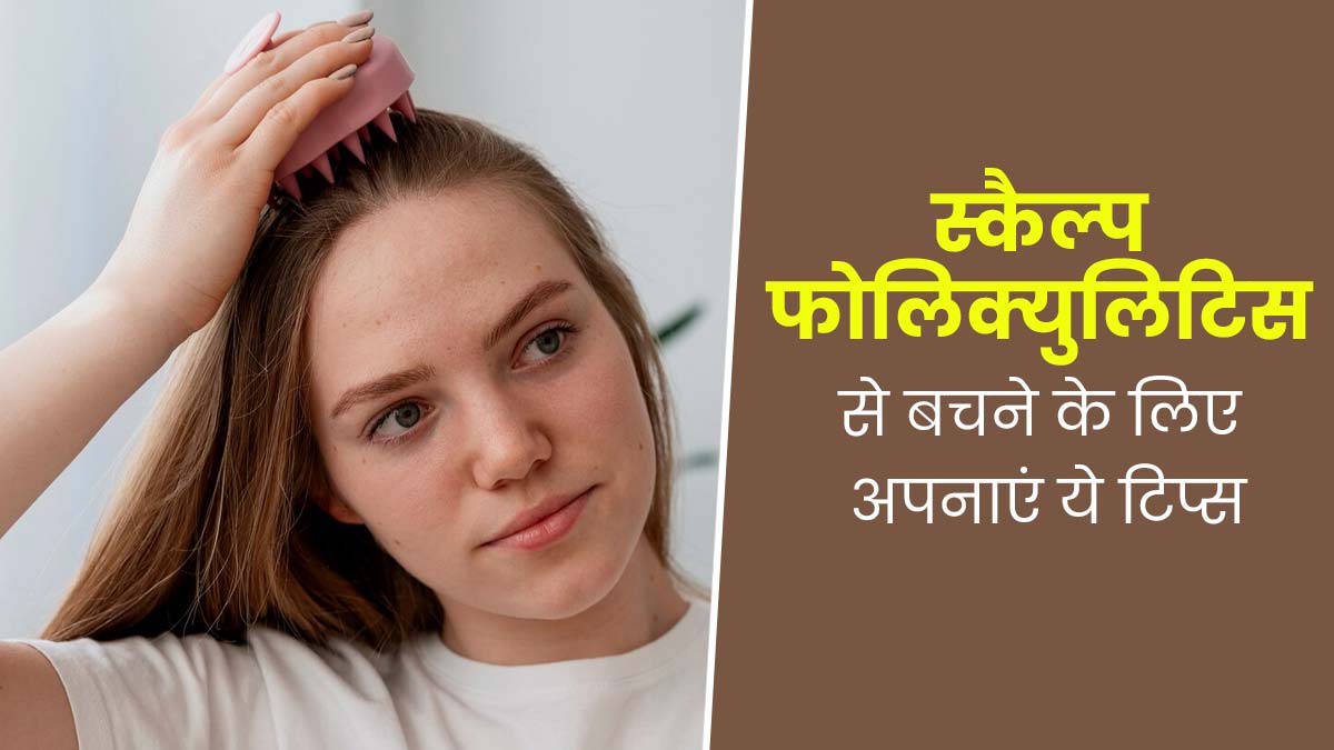 स्कैल्प फॉलिक्युलिटिस (बालों के रोमों में सूजन) से बचने के लिए अपनाएं ये 5 टिप्स, स्कैल्प रहेगा हेल्दी