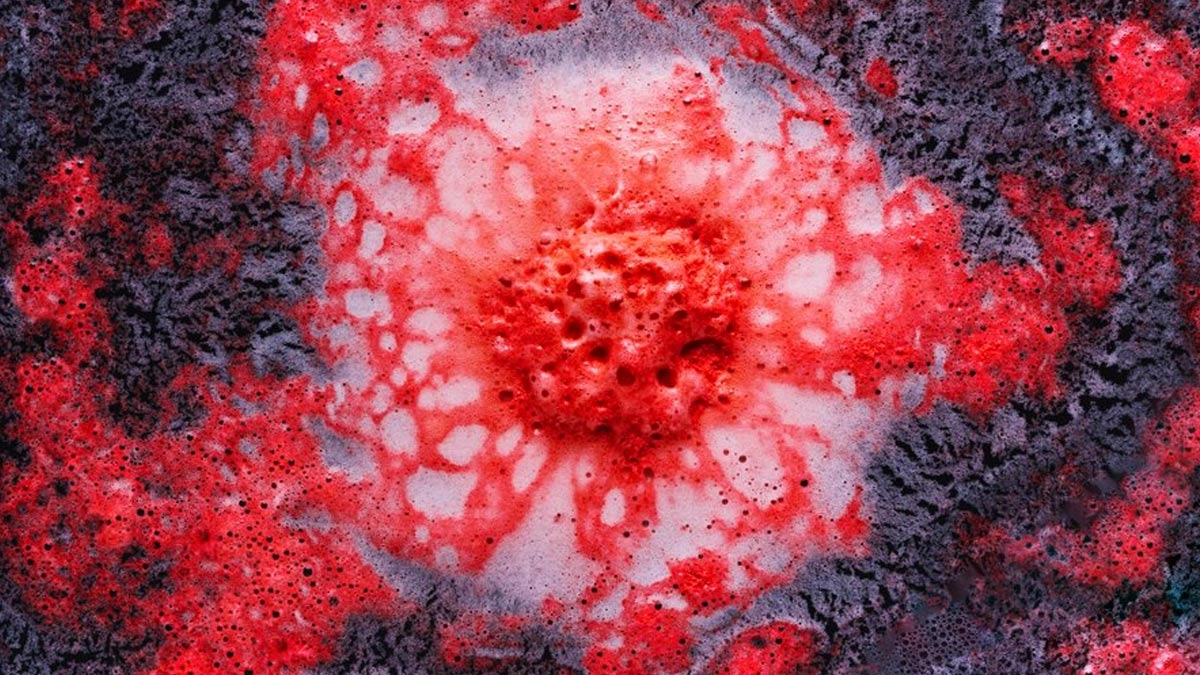 sickle-cell-anaemia