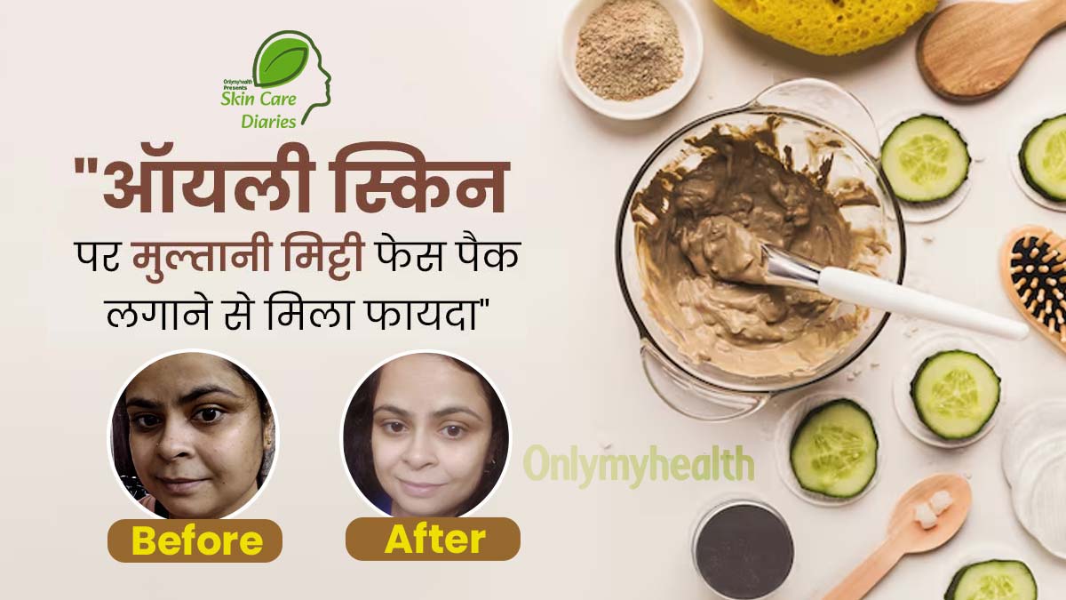 पिछले 2 सालों से चेहरे पर मुल्तानी मिट्टी से बना फेस पैक लगा रही हैं प्रिया तिवारी, ऑयली स्किन से पाया छुटकारा