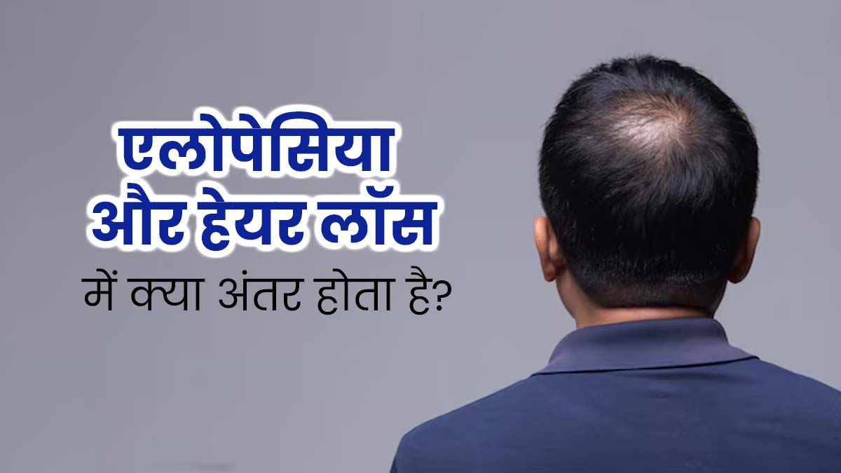 एलोपेसिया और हेयर लॉस में क्या अंतर होता है? जानें बचाव के टिप्स 