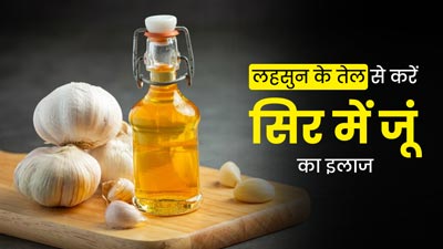 स‍िर में जूं हैं तो लहसुन के तेल का करें इस्तेमाल, इंफेक्शन से भी होगा बचाव
