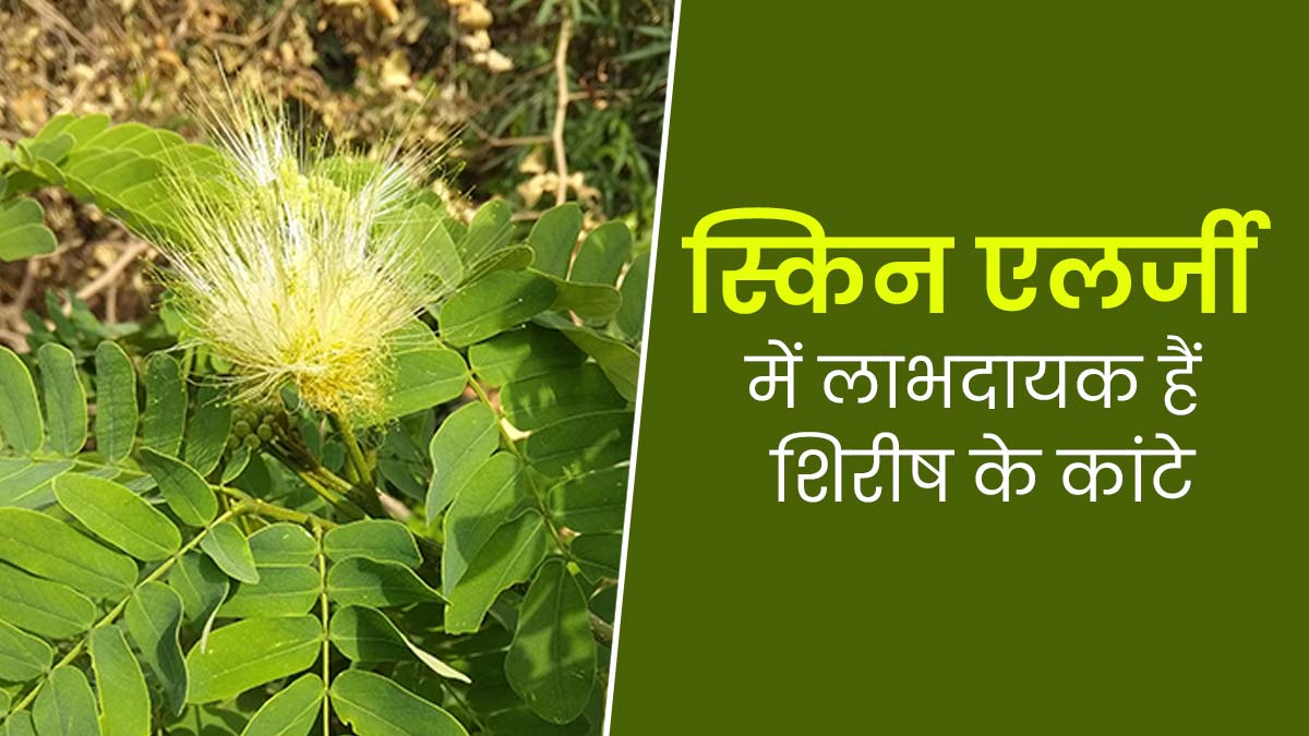 शिरीष के फूल ही नहीं कांटे भी हैं त्वचा के लिए लाभदायक, आयुर्वेदाचार्य से जानें इसके फायदे