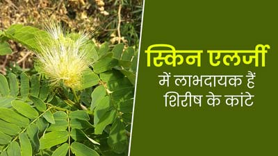 शिरीष के फूल ही नहीं कांटे भी हैं त्वचा के लिए लाभदायक, आयुर्वेदाचार्य से जानें इसके फायदे
