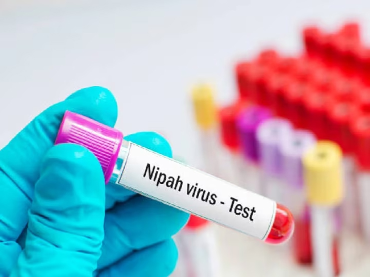Nipah Virus