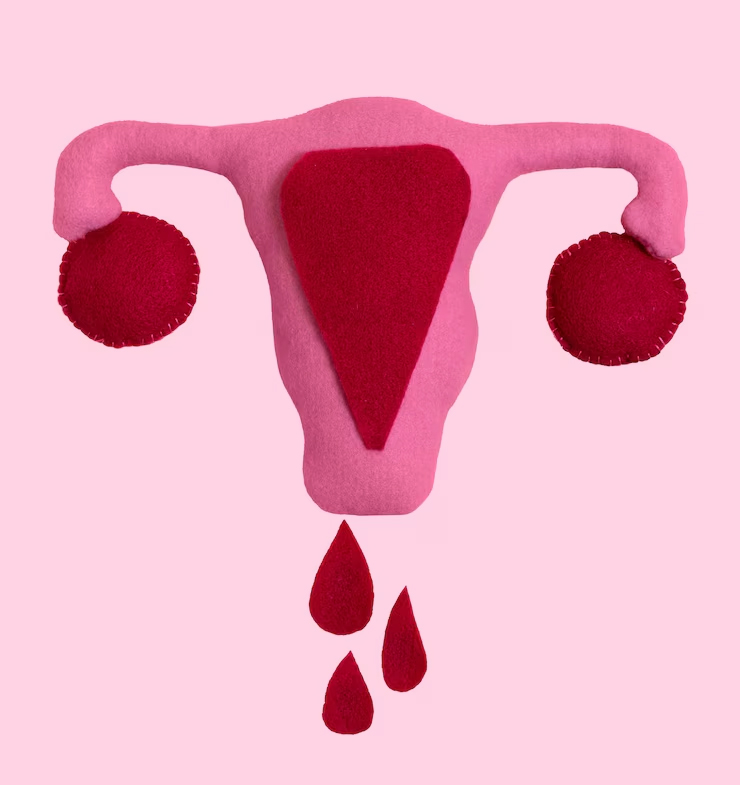 Subchorionic hematoma