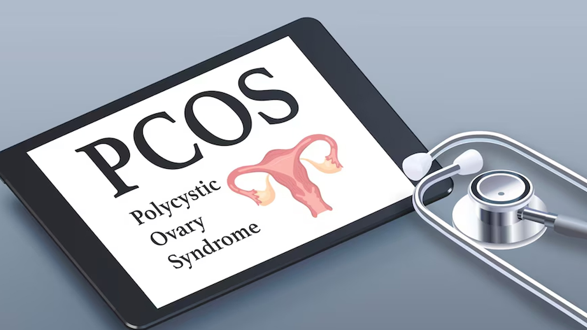 pcos
