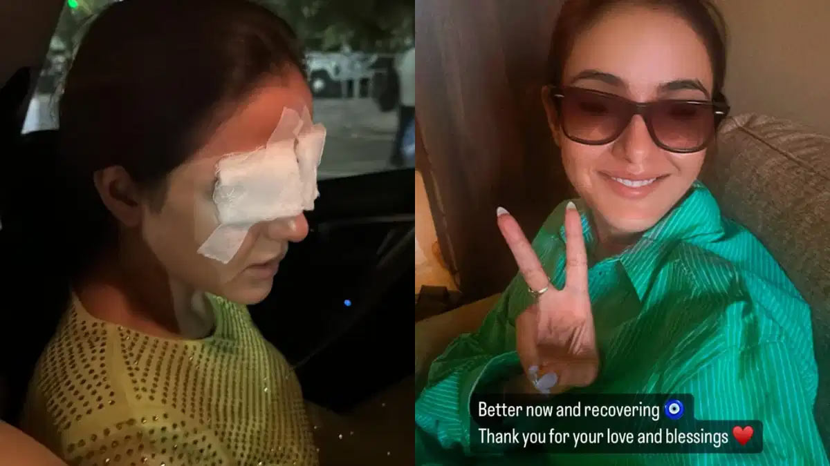 Jasmin Bhasin Reveals Her Corneas Were Damaged After She Wore Lenses; Harmful Effects Of Contact Lenses