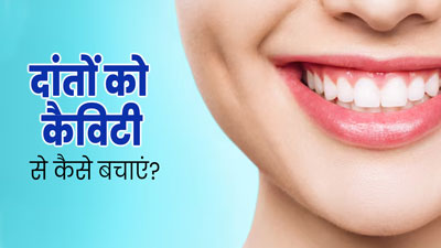 Dental Cavity Prevention: दांतों को कैव‍िटी से कैसे बचाएं? एक्‍सपर्ट से जानें 5 तरीके 