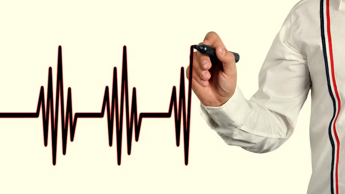 Sinus Arrhythmia: Expert Explains When It's Normal and When to Be Concerned