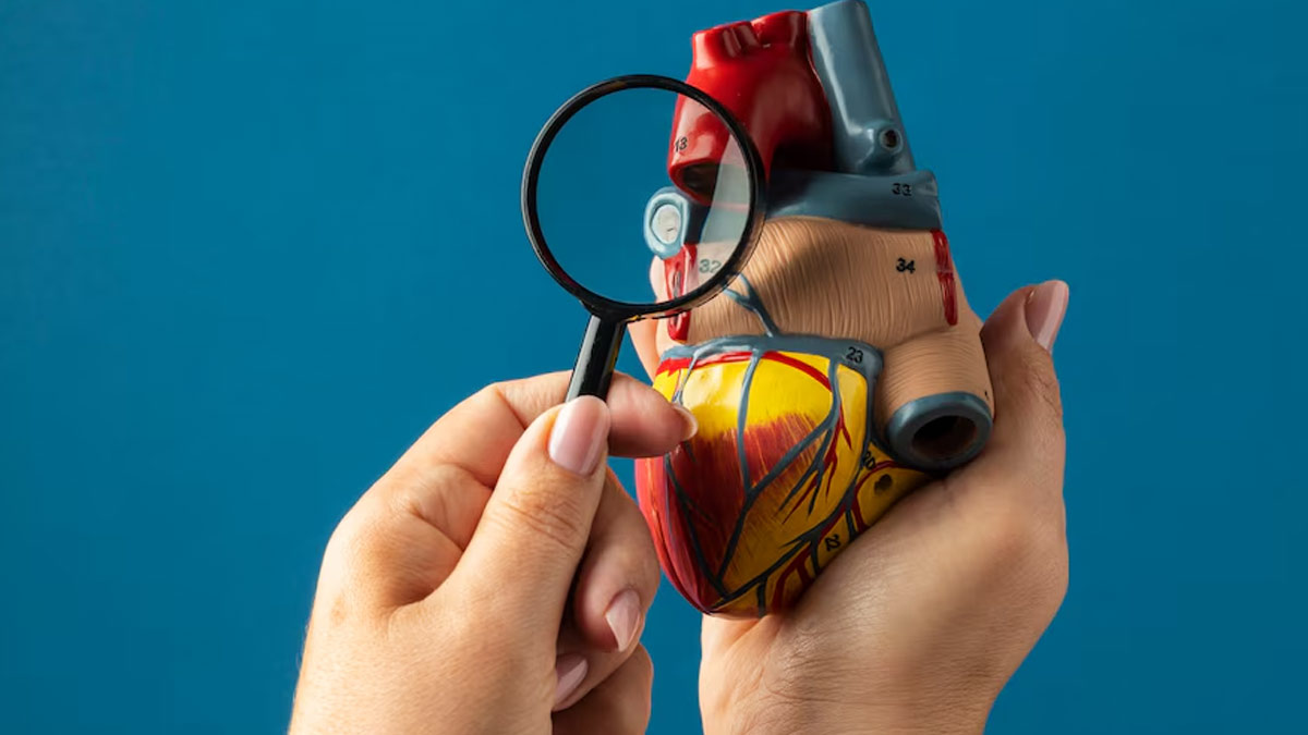 Can You Reverse Coronary Artery Disease? Cardiologist's Insights