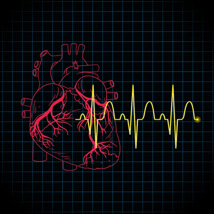 Sinus Arrhythmia: Expert Explains When It's Normal and When to Be ...