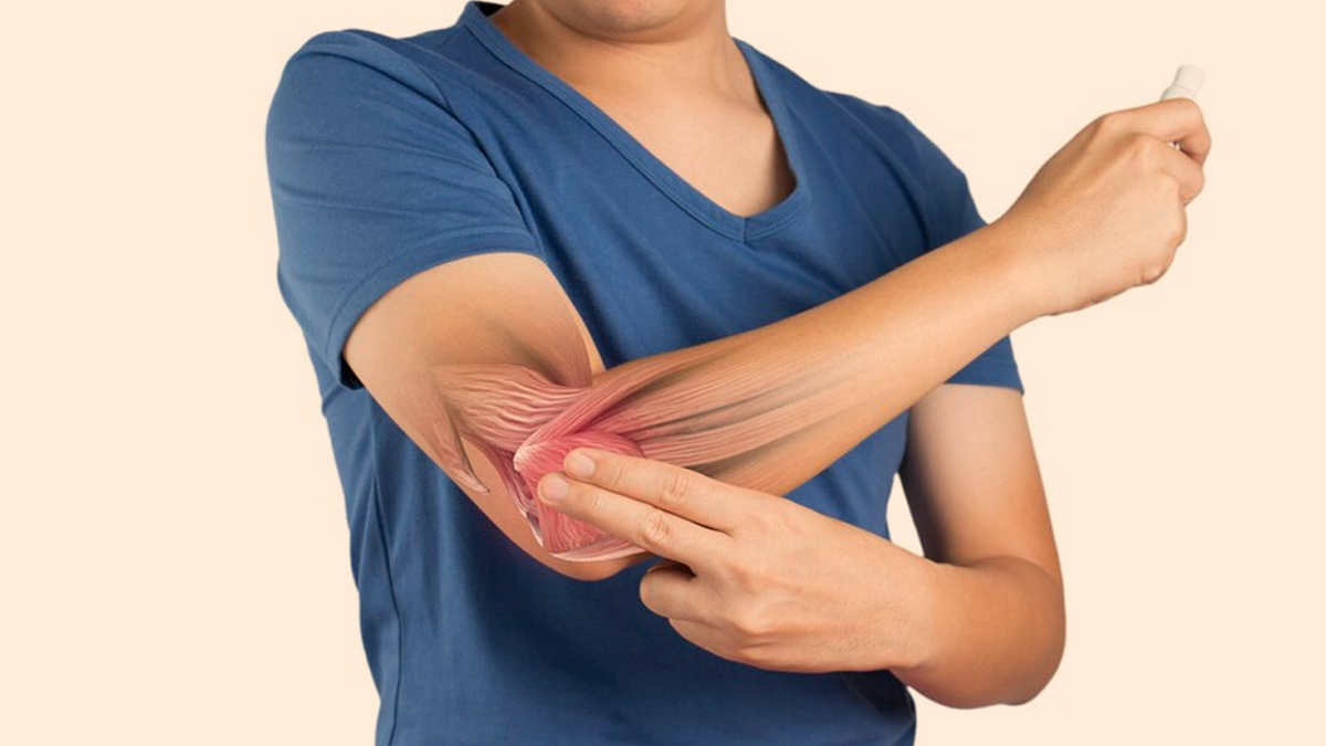 How To Know If You Have Bursitis? Watch Out For These Symptoms