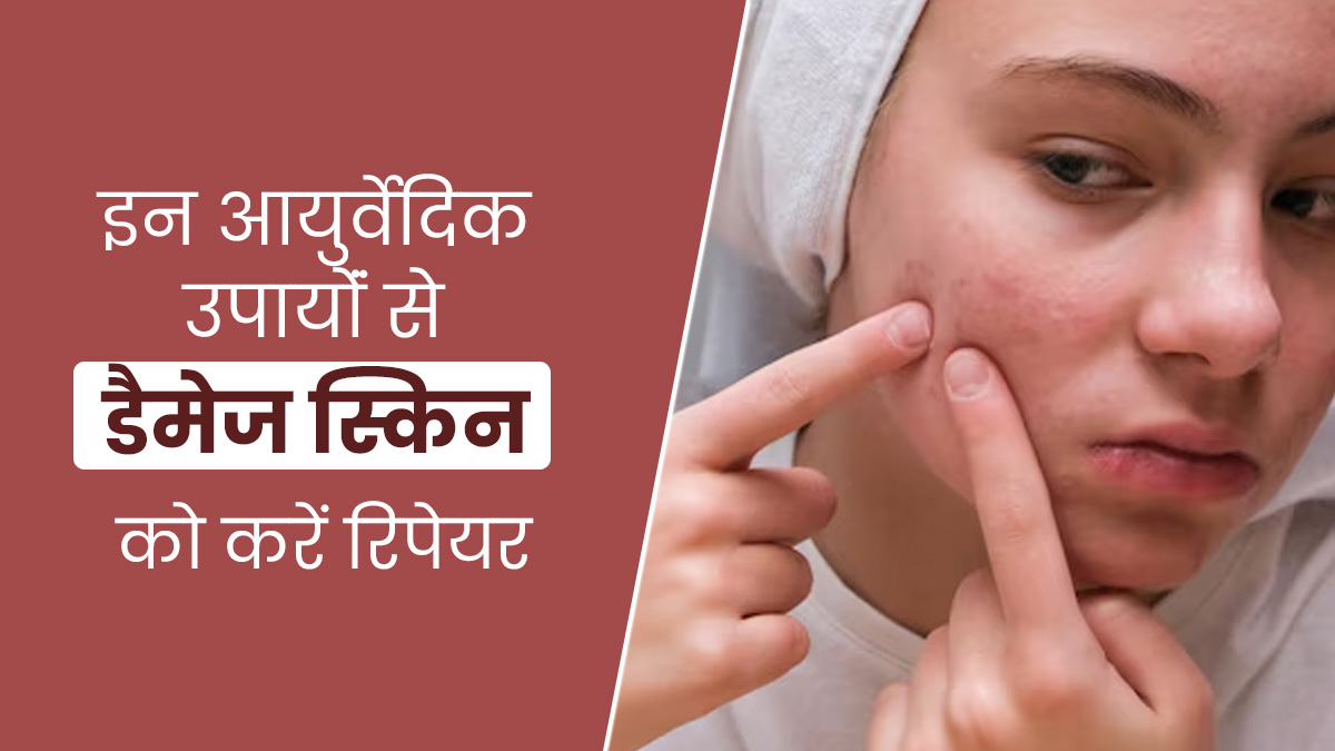 इन 5 आयुर्वेदिक उपायोंं से डैमेज स्किन को करें रिपेयर, मिलेगी जल्द राहत
