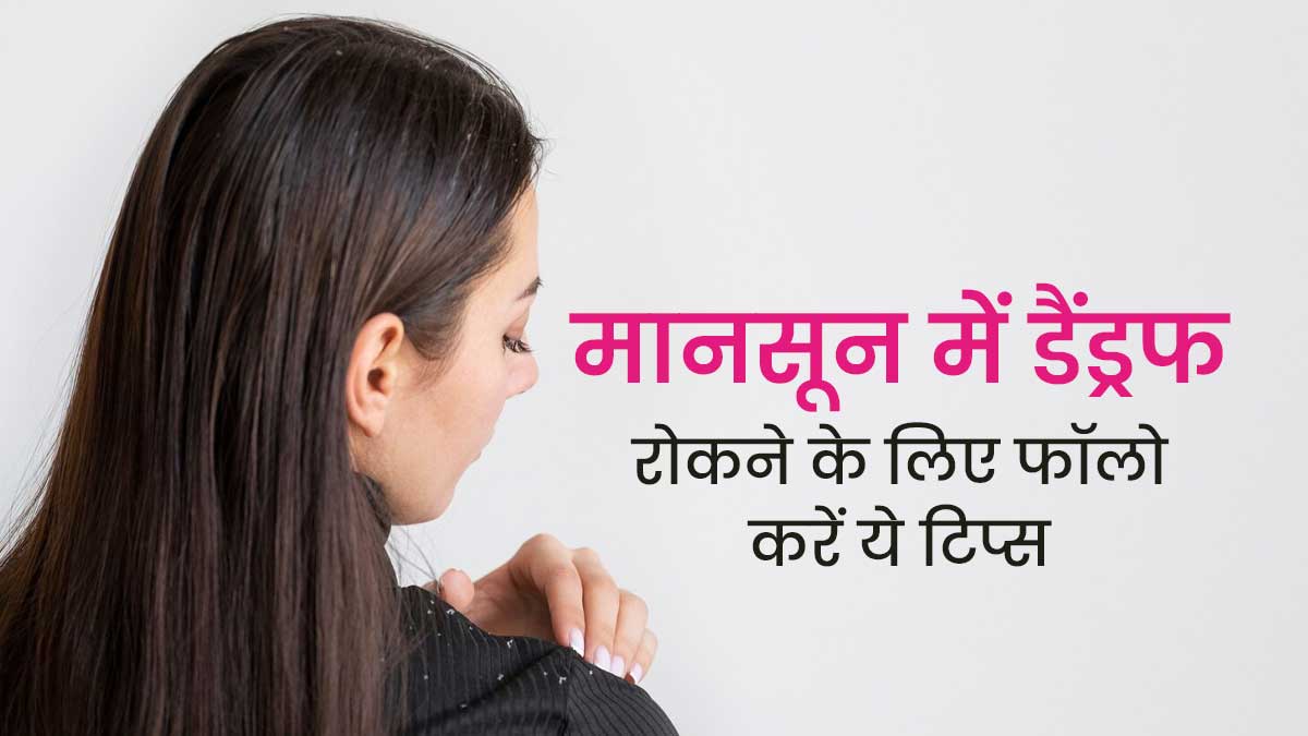 मानसून में डैंड्रफ से छुटकारा पाने के लिए अपनाएं ये टिप्स, स्कैल्प इंफेक्शन से भी होगा बचाव