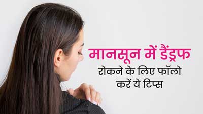 मानसून में डैंड्रफ से छुटकारा पाने के लिए अपनाएं ये टिप्स, स्कैल्प इंफेक्शन से भी होगा बचाव