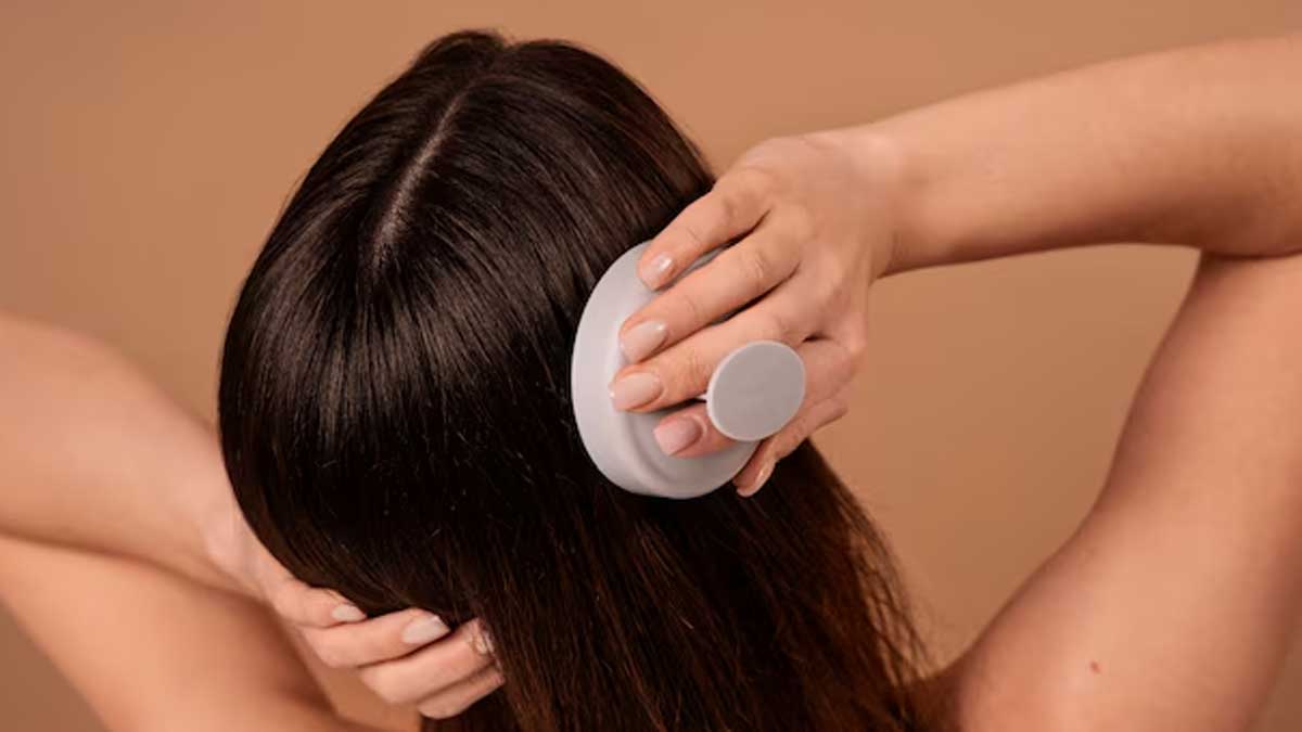 dandruff