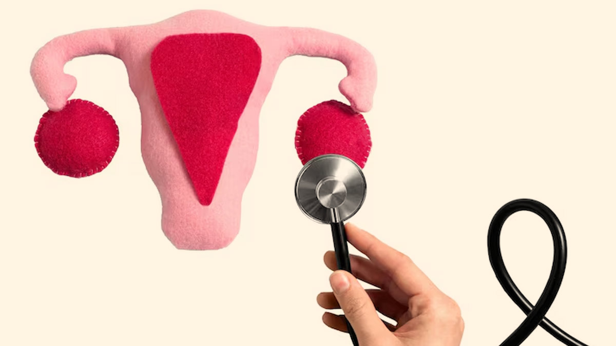 When Should You Get Tested For PCOS? Types, Cost And Dos And Don'ts