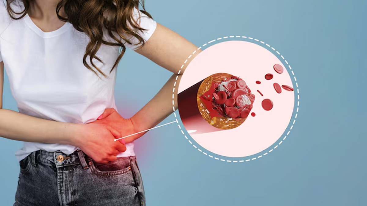 is neem seeds good for kidney stones