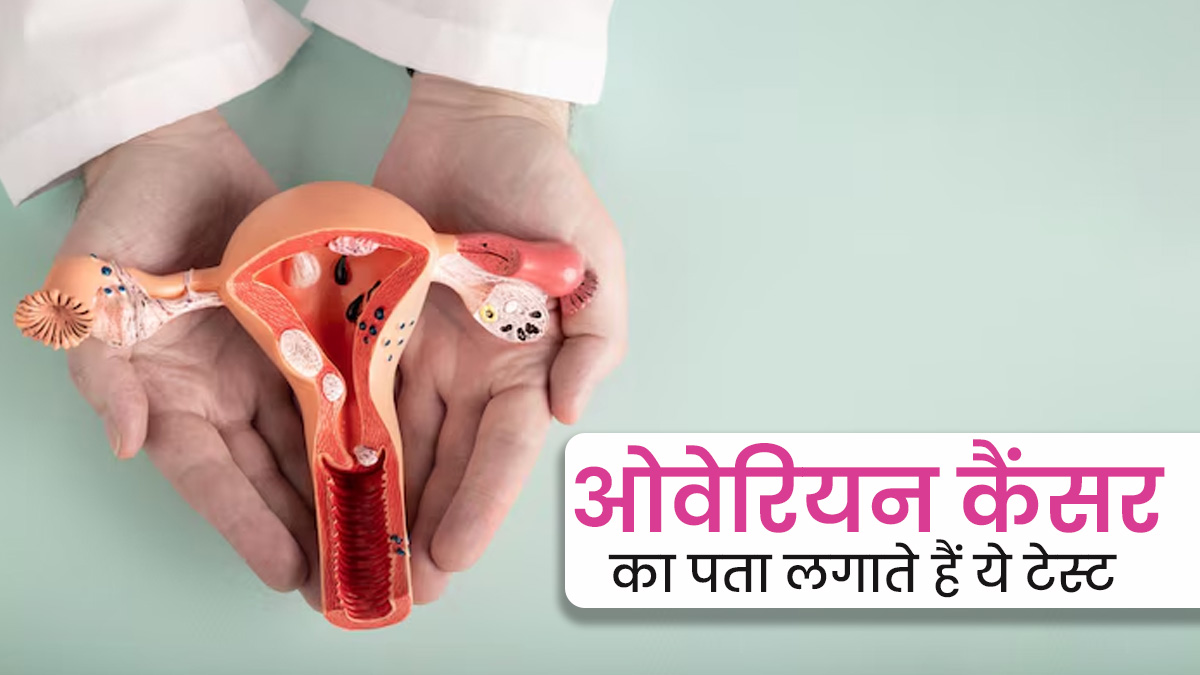 Ovarian Cancer: मह‍िलाओं में होने वाली जानलेवा बीमारी है ओवेर‍ियन कैंसर, जानें कैसे होती है इसकी जांच