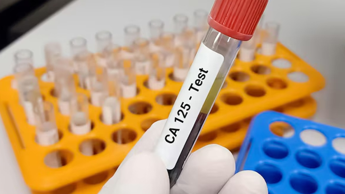 ovarian cancer in hindi