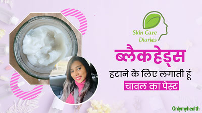 ब्लैकहेड्स से परेशान थीं शिल्पा, हटाने के लिए लगाया चावल का पेस्ट, आप भी कर सकते हैं ट्राई