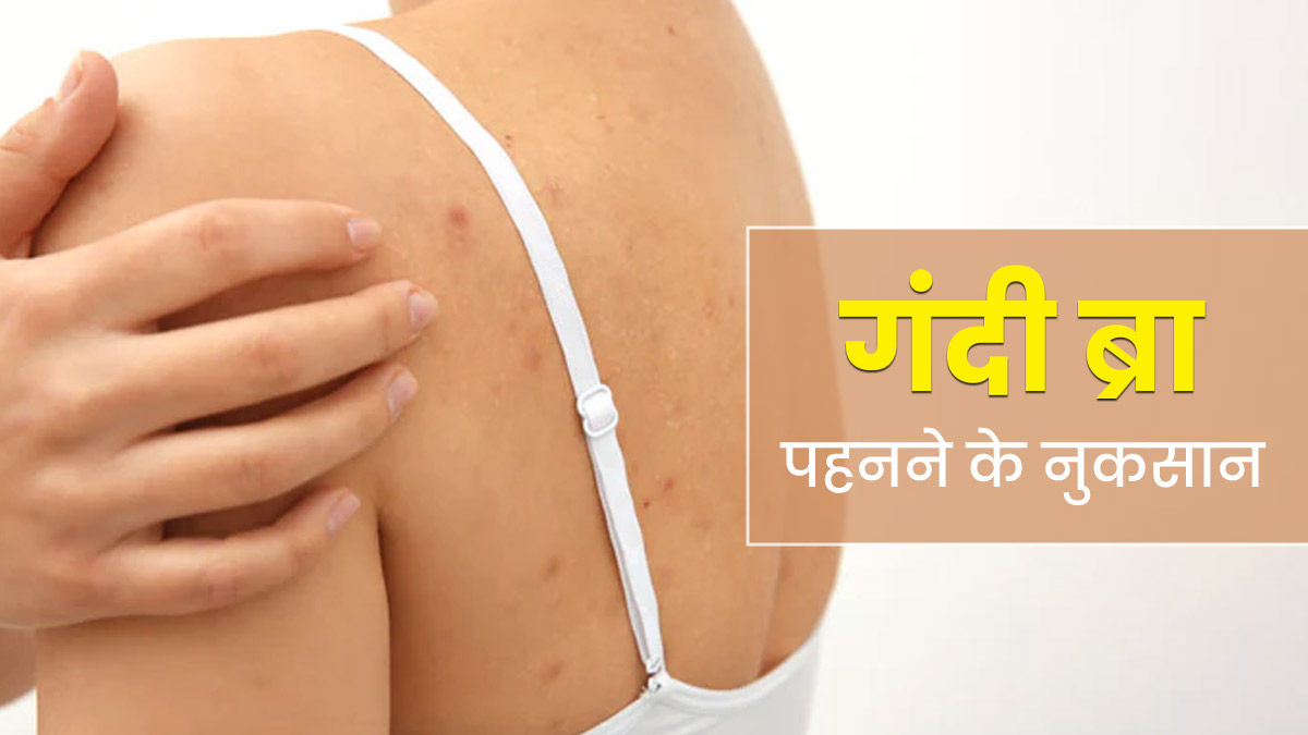 गंदी ब्रा से तो नहीं हो रहे पीठ में दाने? जानें ब्रा पहनने के गलत ढंग से त्‍वचा को होने वाले नुकसान 