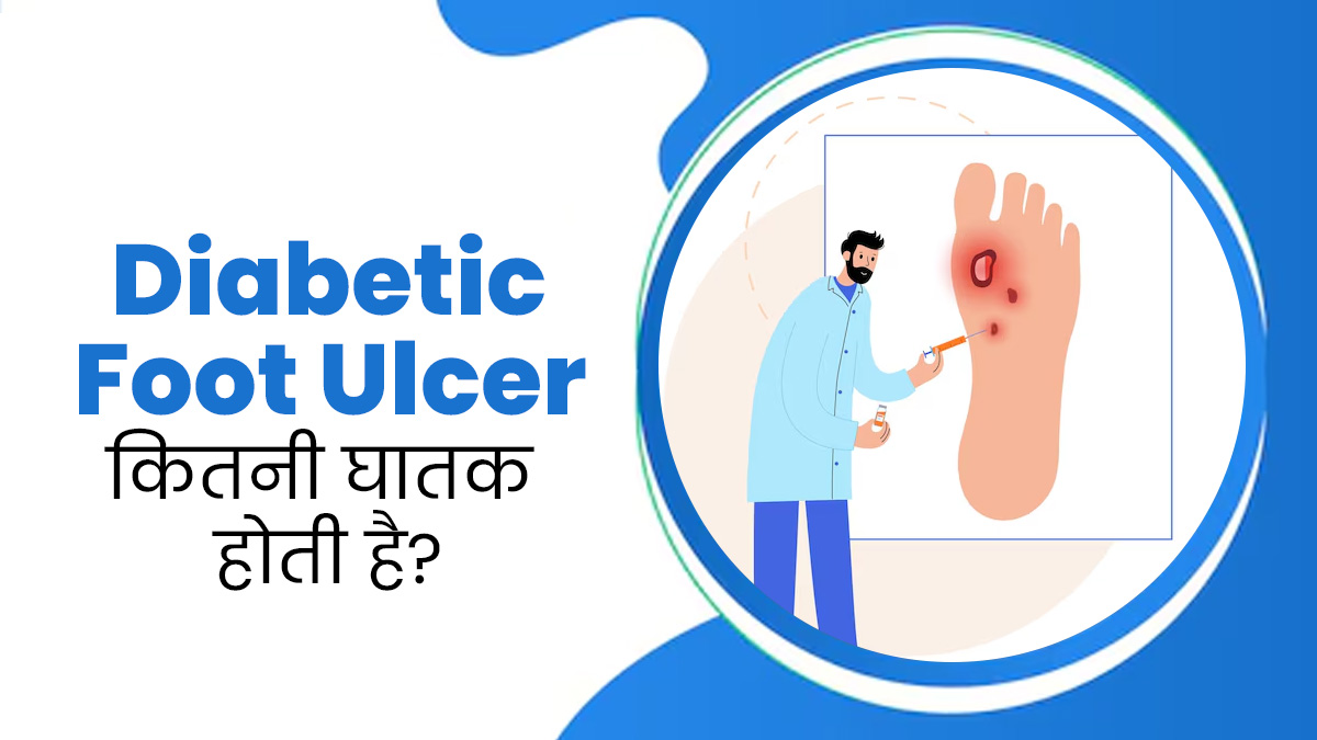 Diabetic Foot Ulcer: डायबिटिक फुट अल्सर की शुरुआती स्टेज कितनी घातक होती है? जानें एक्सपर्ट से