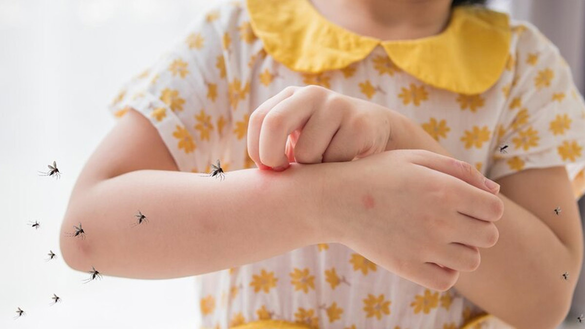 Telangana Witnesses Rise In Chikungunya Cases Among Children, How To Keep Kids Safe In Monsoon