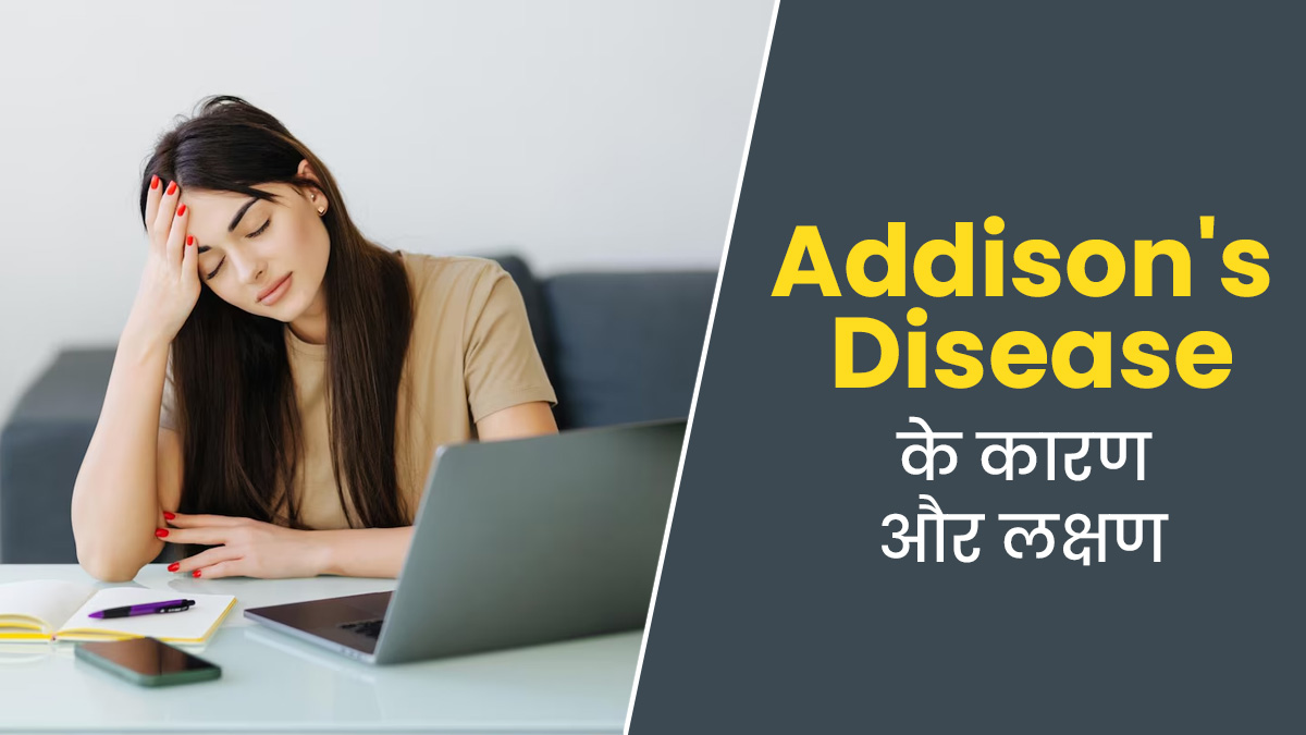 थकान और चिड़चिड़ापन हो सकता है एडिसन रोग का संकेत, जानें इसके लक्षण और कारण