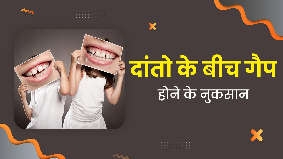 Teeth Gaps: दांतों के बीच गैप क्यों होता है? जानें इससे होने वाले नुकसान 