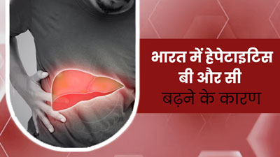 ABC of Hepatitis: इंडिया में तेजी से बढ़ रहे हैं हेपेटाइटिस बी और सी के मामले, जानें इसके पीछे के कारण