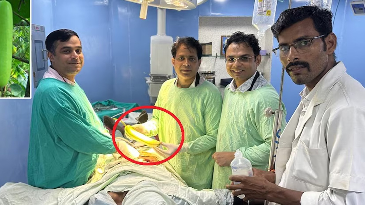 मध्य प्रदेश के छतरपुर में व्यक्ति के मलाशय से निकली 16 इंच लंबी लौकी, दो घंटे तक चला ऑपरेशन 