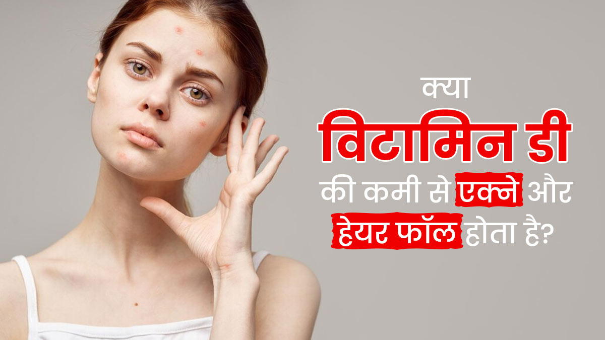 क्या विटामिन डी की कमी से एक्ने और बाल झड़ने की समस्या होती है? डॉक्टर से जानें कारण 