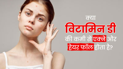 क्या विटामिन डी की कमी से एक्ने और बाल झड़ने की समस्या होती है? डॉक्टर से जानें कारण 