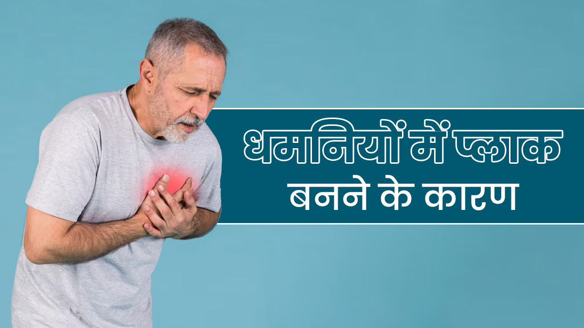 धमनियों में कैसे बनता है प्लाक? एक्सपर्ट से जानें इसे साफ करने के तरीके 